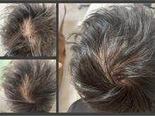 グロー 熊本(GROW)の雰囲気（【ビフォーアフター】頭皮環境を整えて育毛促進！髪質改善も◎）
