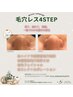 冬季限定！!毛穴特化の【毛穴レス美肌４STEP】Q pay利用¥24,100→