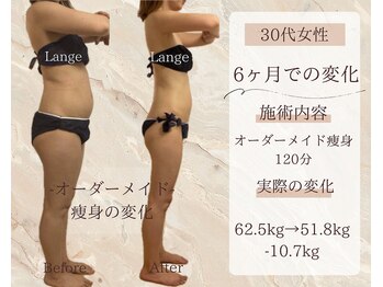 サロン ド ボーテ ラーンジュ 岐阜店(salon de beaut'e L'ange)/ハイパ-ナイフEX2ダイエット痩身