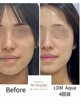 リサプリ(Re: Supple)/若くても差がつく!立体フェイス