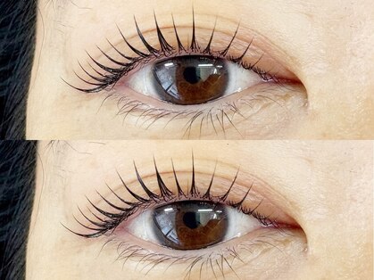 パトラ(PATRA)の写真