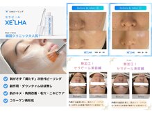 ホジュン鍼灸整体院の雰囲気（たった1回で実感！韓国式ピーリング×美容鍼毛穴もたるみも同時）