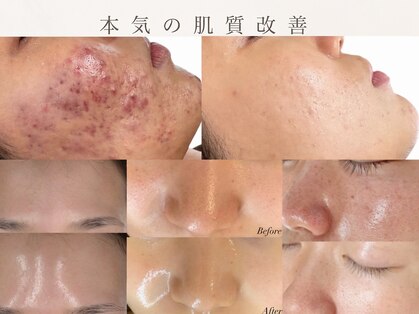 ルブラン(Lu'Bulan)の写真