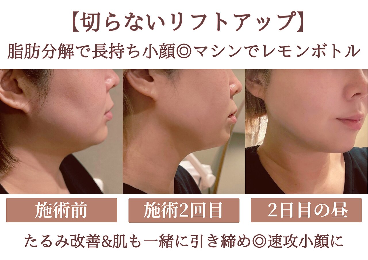エス シークレット 金町店(S secret)｜ホットペッパービューティー