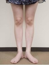 新橋赤レンガ通りカイロプラクティック/美脚矯正でO脚改善！！