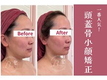 ビレナ 守谷店(Birena)/Ｂｉｒｅｎａ式頭蓋骨小顔矯正