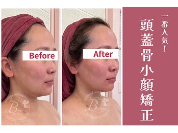 ビレナ 守谷店(Birena)/Birena式頭蓋骨小顔矯正