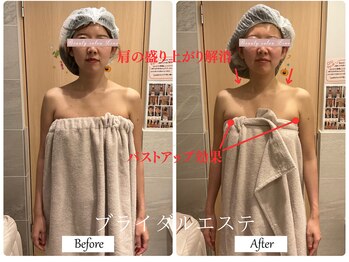 リノ(Lino)/ブライダルエステ