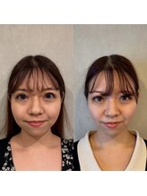 ココロ美容整体院(cocoro)/小顔調整 BeforeAfter