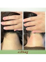 ワクシングサロン ツィター(Waxing salon zither)/【新大阪/東淀川】うなじ脱毛