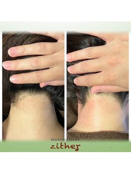 ワクシングサロン ツィター(Waxing salon zither)/【新大阪/東淀川】うなじ脱毛