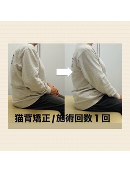 おはな整骨院 健軍東院の写真/3/28・30・31の3日間限定で猫背矯正クーポン発行！！
「猫背」「巻き肩」「肩こり」などでお悩みの方へ！