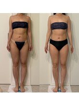 ミヨン(Miyong)/ウエスト回りがすっきり♪