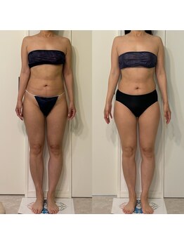 ミヨン(Miyong)/ウエスト回りがすっきり♪