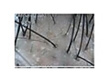 エルール トータルビューティ(Aileure total beauty)/育毛促進ケア　