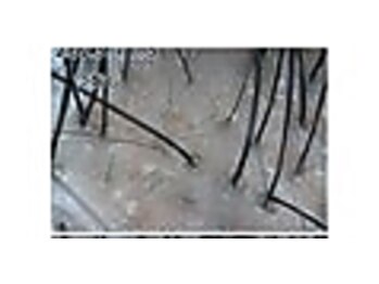 エルール トータルビューティ(Aileure total beauty)/育毛促進ケア　