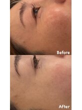 アレッド 大阪店(ared.)/効果に自信あり