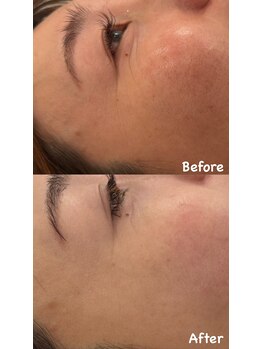 アレッド 大阪店(ared.)/効果に自信あり