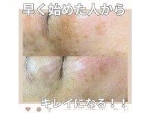 シンプル(Simple)の雰囲気（シミにはもう悩まない、土台から変えて、隠すを卒業♪）