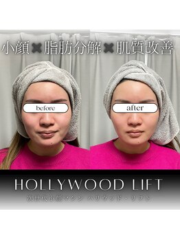 ブリリオプラス 四条烏丸店(Brillio plus)/ハリウッド×レモンボトル