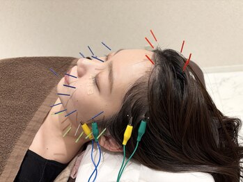 クマノミ美容鍼灸 銀座院(KUMANOMI美容鍼灸)/ぐっとリフトUPし小顔が定着！