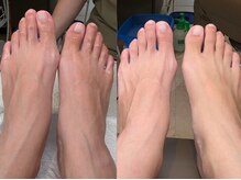 ハビッツ(habits)/超濃密炭酸泡美白パック