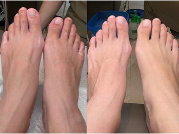 ハビッツ(habits)/超濃密炭酸泡美白パック