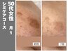 人気No3【シミにお悩みの方】肌のトーンUP!くすみ・色ムラ改善◎均一艶肌へ