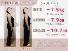 整体院ルーツケア/50代 3ヵ月ダイエット(痩身)成果