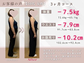 整体院ルーツケア/50代 3ヵ月ダイエット(痩身)成果