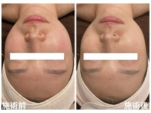 チェンジ(Change)/