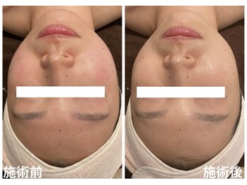 チェンジ(Change)/