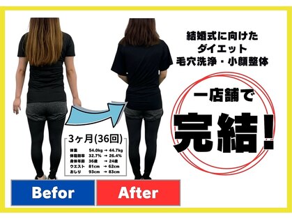 ブライトプラス(BRIGHT+)の写真