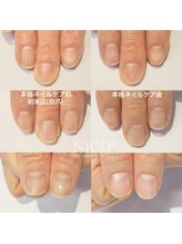 ニコプラス(NICO+)/ジェルネイルができない方向け