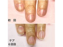 ココデネイル(cocode nail)/小さな爪がコンプレックス…