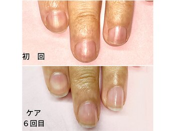 ココデネイル(cocode nail)/小さな爪がコンプレックス…