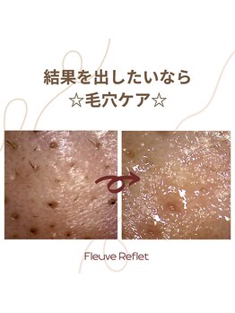 フルーヴ ルフレ(Fleuve Reflet)/毛穴ケアはサロンで★