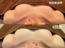 整顔整頭/スタンダードバストケア(8回)