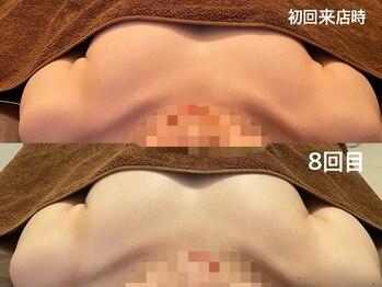 整顔整頭/スタンダードバストケア(8回)