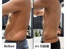 キムラケ(KIMURAKE)の雰囲気（【ボディ脂肪分解】5回の結果！憧れのスリムの身体に）