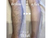 メンズ脱毛 ウィッシュ(Wish)の雰囲気（足もその場でキレイになれる”ダブル脱毛”でスッキリ♪）