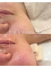 ナビ ビューティー(NABI Beauty)/美肌の為のフェイシャルワックス