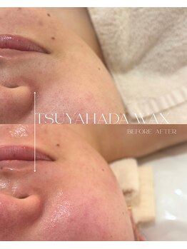 ナビ ビューティー(NABI Beauty)/美肌の為のフェイシャルワックス