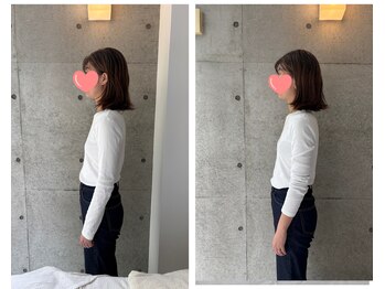 にゅうどうぐも(nyudougumo)/ビフォーアフター