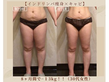 オキシー グレイス 黒崎店(OXY Grace)/脚スッキリ！インド×キャビ