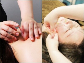 リマナ(Limana)の写真/《自分ではどうにもならない悩みに》女性鍼灸エステティシャンが解消◎希少な立体造顔美容鍼もございます＊