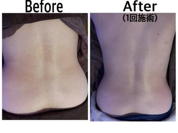 ホーリーハウス(Holy House)/レッドショット1回での効果♪