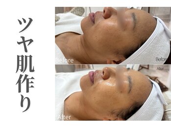 エトレ(etre)/ピーリング/肌育/シワ/たるみ