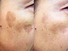 サロン ド ピュール(SALON DE PURE)