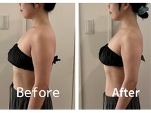 ヴィヴィの雰囲気（フェイシャル＋プチBODYでフェイスラインも上半身もスッキリ！）